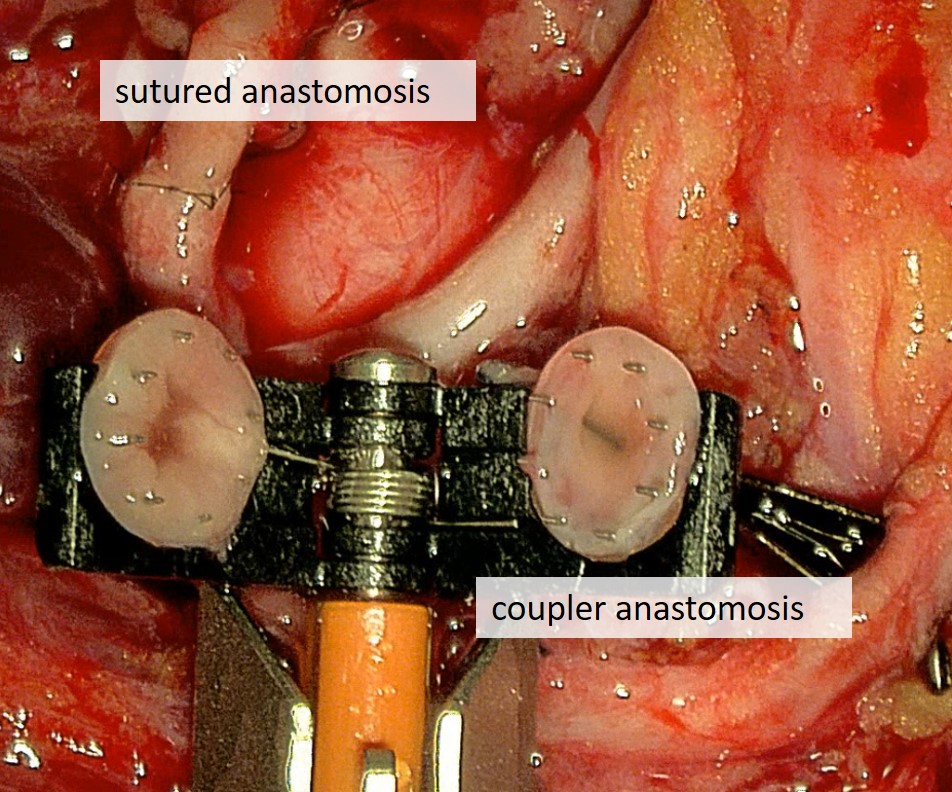 microsurgical concept